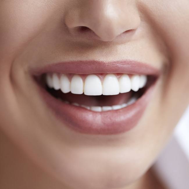 Flawless smile with metal free dental restoration