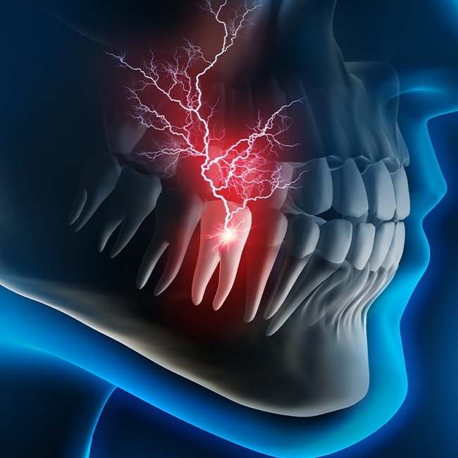 Animated smile with lightning striking mouth symbolizing toothache