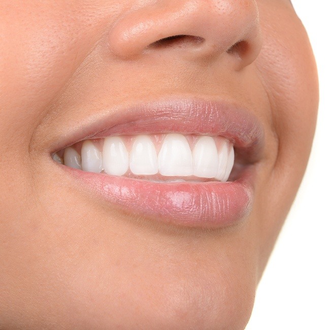 Patient smiling after gum grafting treatment