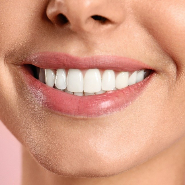 Closeup of smile after dental implant tooth replacement