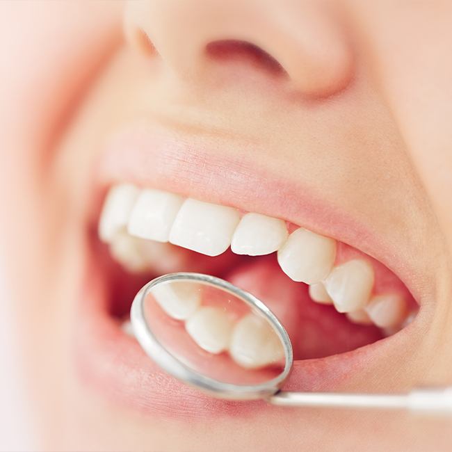 Closeup of smile after tooth colored filling treatment