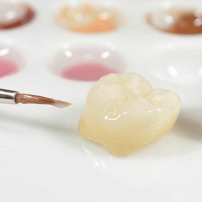 Dental crown restoration