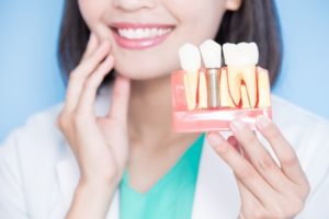 Dentist holding a model of dental implants.