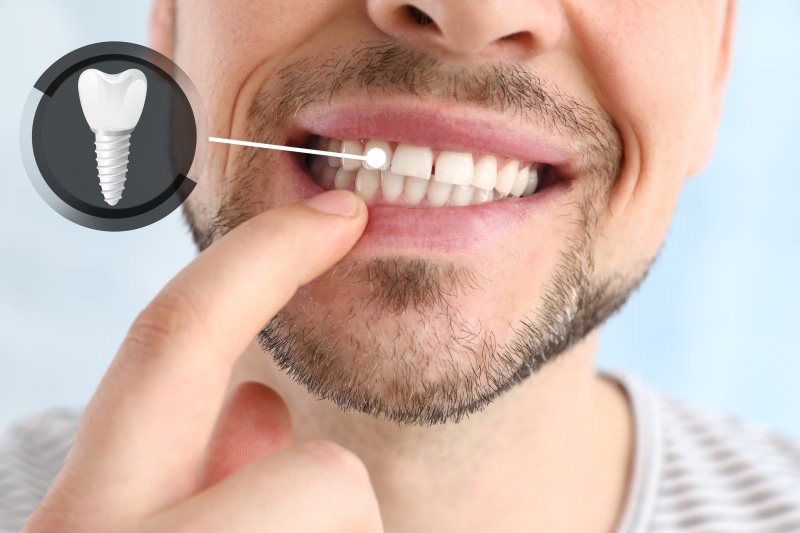 A patient experiencing dental implant success